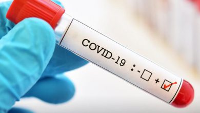 تست کرونا - رادیو قبرس