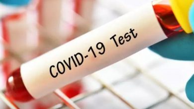 تست کرونا - رادیو قبرس