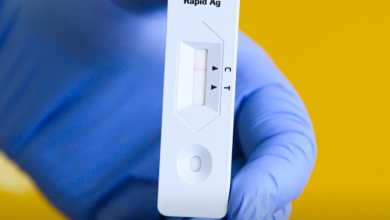 کیت آزمایش - رادیو قبرس